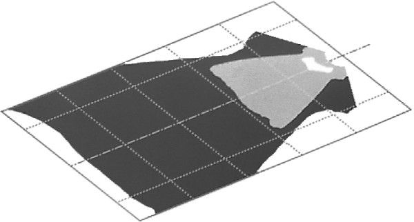 HELLA Arbeitsscheinwerfer (1GA 006 876-001)